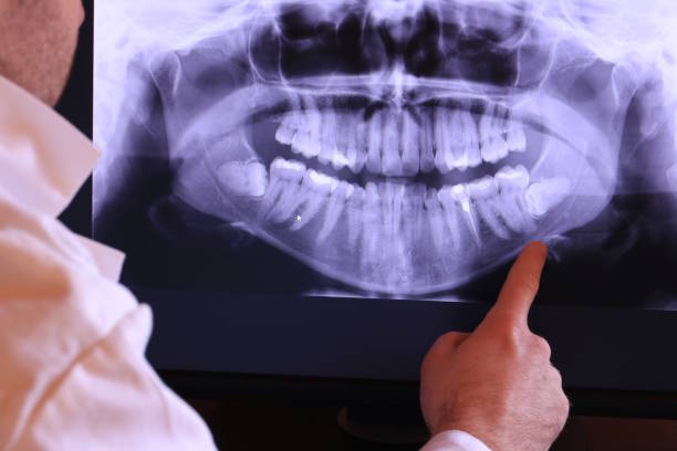 Best Emergency TMJ Treatment in Oconto Falls, WI